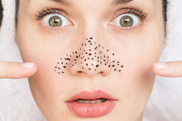 스펙트라 레이저필